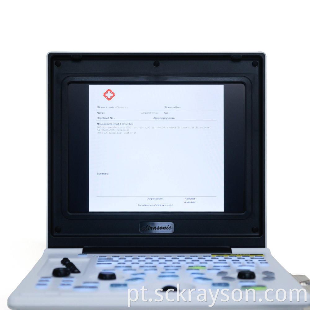 Laptop Ultrasound Screen 9
